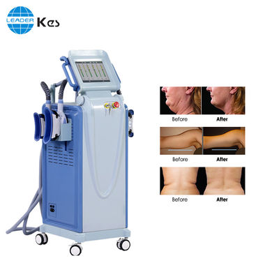 10.4 TFT 판매 부동액 막을 위한 수직 체중을 줄이는 기계 베스트셀러 cryolipolysis 기계
