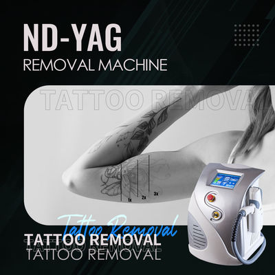 ND YAG 레이저 1064nm 532nm 문신 제거 기계 1320nm 탄소 껍질